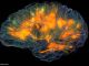 Real Time 3D Brain Visualization Depicting Source-localized Activity!