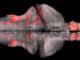 Amazing Zebrafish's Brain Neurons Firing