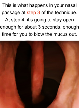 Inflated nasal passage at step 3