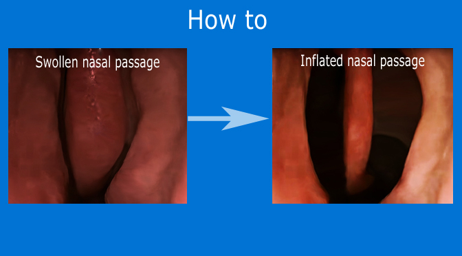How to decongest stuffy nose