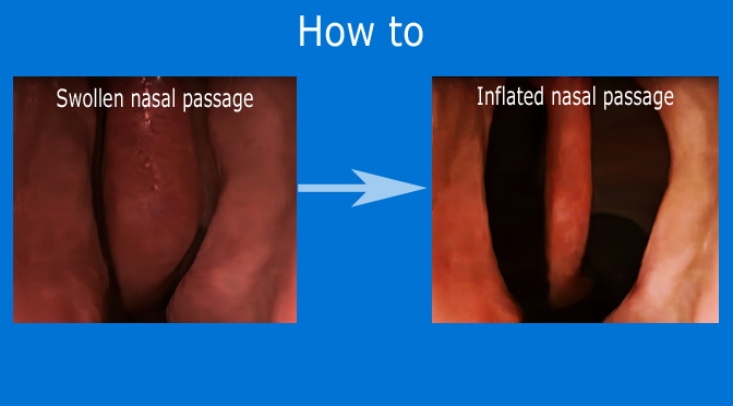 A technique to decongest a stuffy nose ASAP