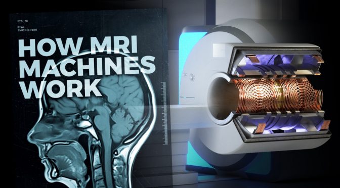Unveiling the Intricate World of MRI Machines